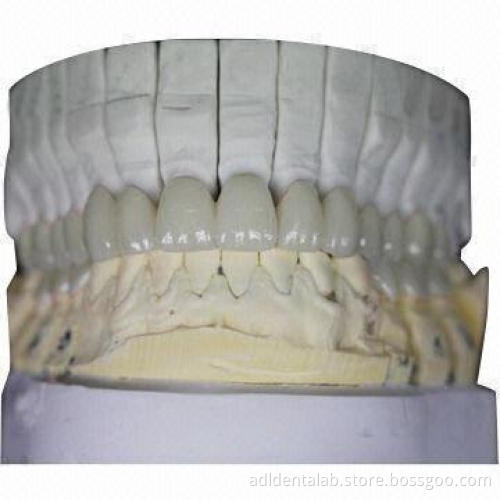 Zirconia Bridge, 100% Biocompatible